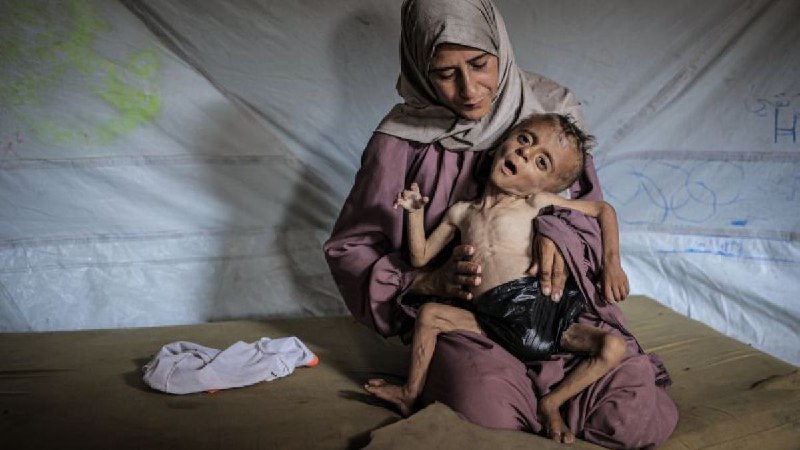 饥饿肆虐加沙儿童，而世界却在冷眼旁观